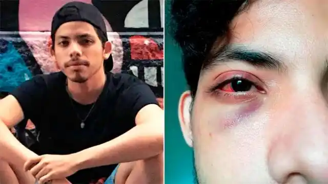 Patota de siete hombres atacó a un joven por ser gay