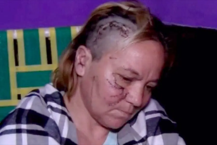 Habló mujer atacada por dos pitbulls: "Si yo soltaba a la nena, se la devoraban"