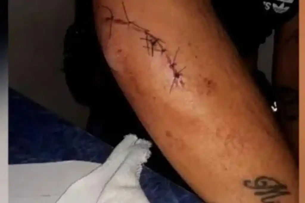 Una joven denunció que fue brutalmente agredida por dos patovicas en un bar