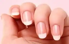 5 problemas muy normales que aparecen en las uñas