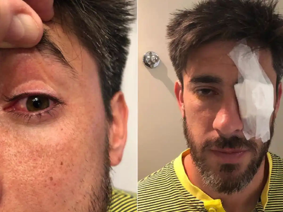 Habló el médico que atendió a Pablo Pérez: "La lesión que tiene le imposibilita la visión"