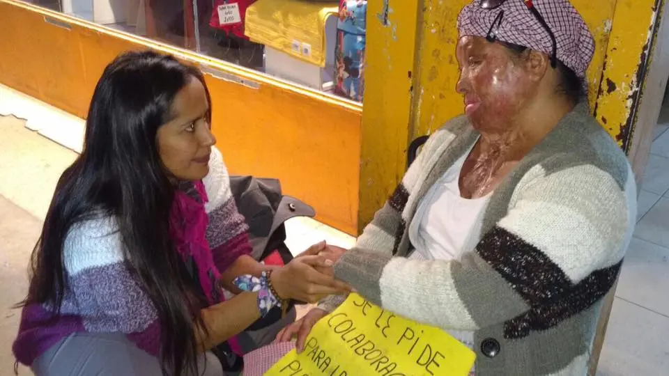 El drama de una víctima de violencia de género que pide ayuda para una cirugía en el Conurbano
