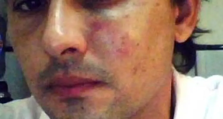 Matías Velo aseguró que va a la Justicia por la agresión sufrida el fin de semana