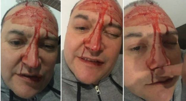 “Me pegaron por ser homosexual”: Leo García fue agredido físicamente