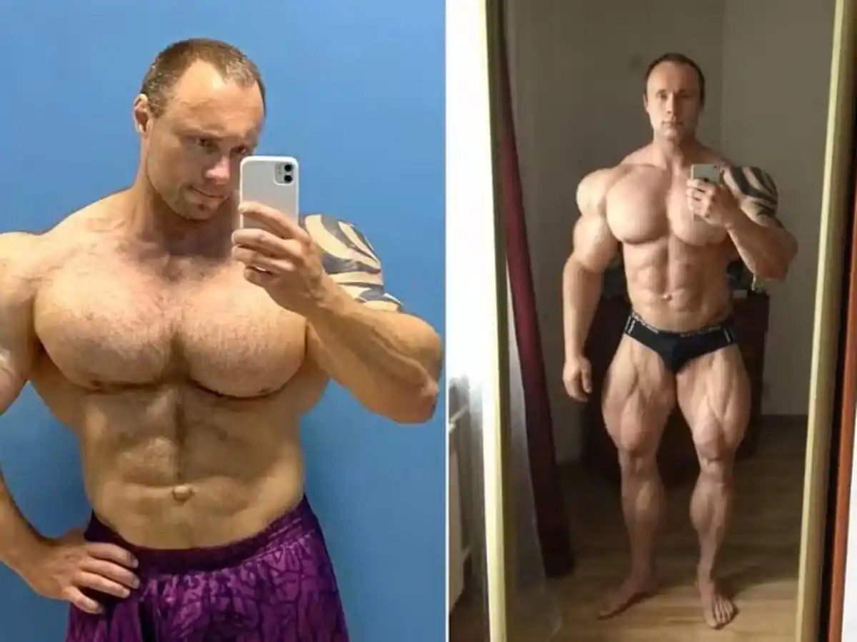 Murió el “Hulk ruso” tras inyectarse Synthol: tenía 35 años y padecía un fallo orgánico
