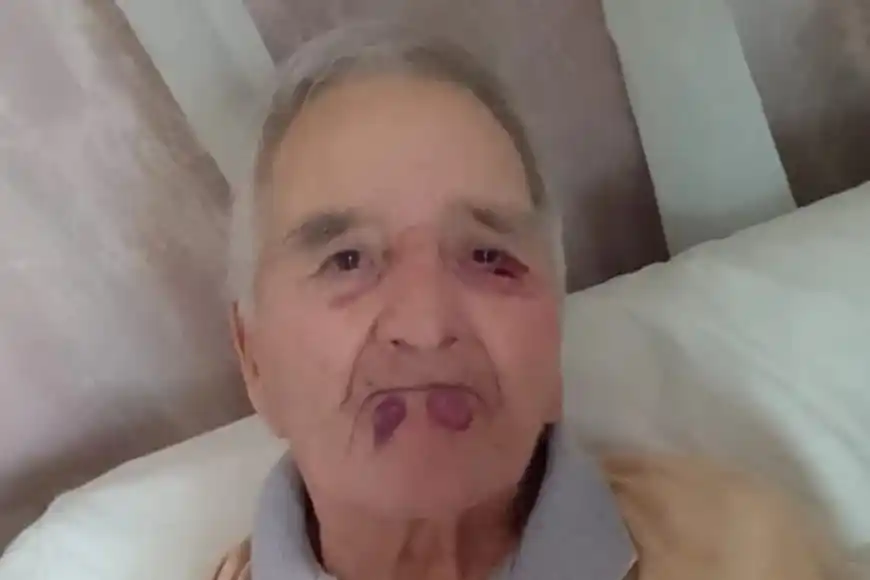 Golpearon brutalmente a un hombre de 89 años en un geriátrico de Mar del Plata: el maltrato quedó filmado