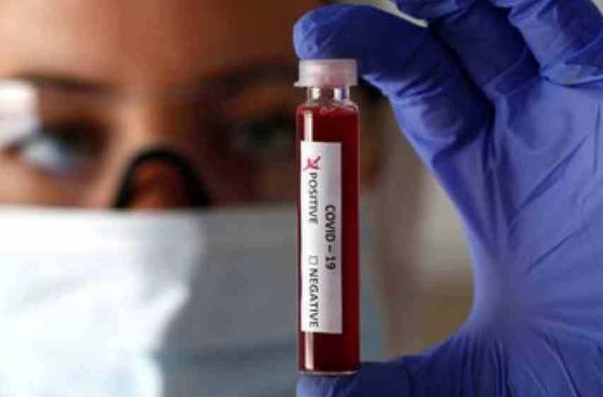 Coronavirus en Argentina: confirmaron 29 nuevos fallecidos y la cifra de víctimas fatales asciende a 2.617
