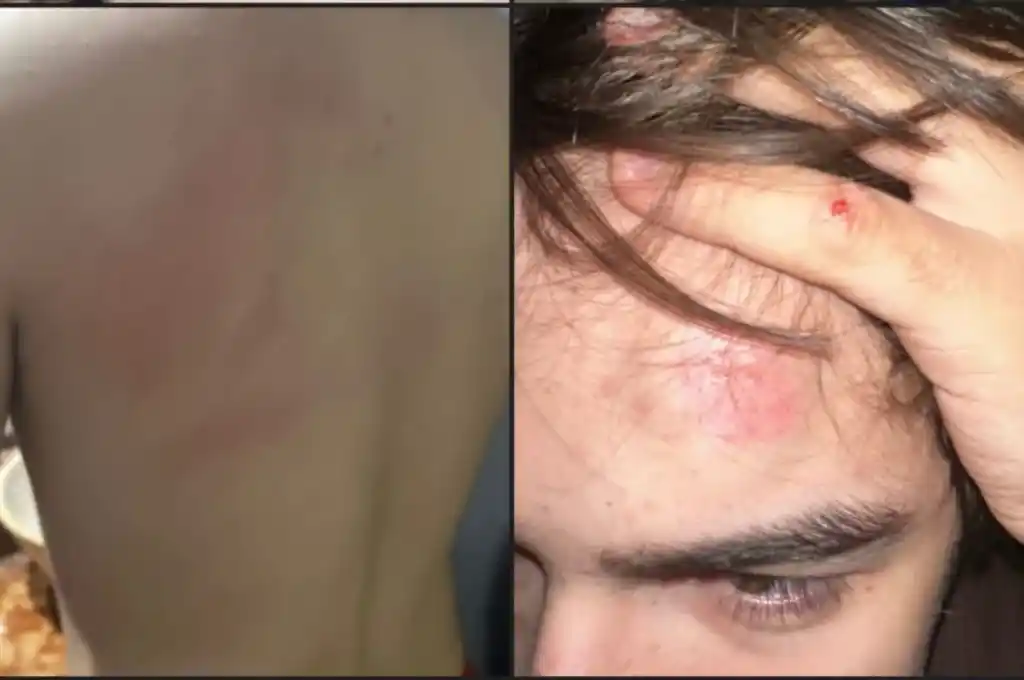 pelea de perros santo tome 2