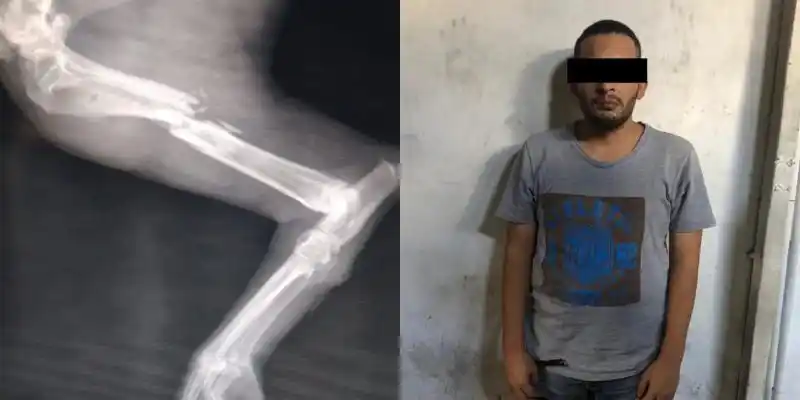 Meten preso en Chacao a hombre que le pegó a un perro con un amortiguador