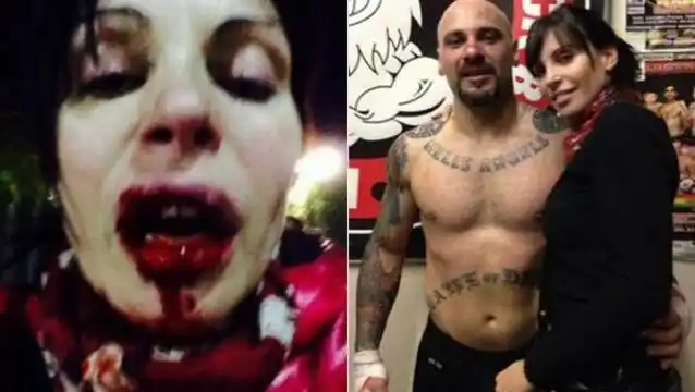 Peleador profesional de kick boxing desfiguró a su novia a golpes