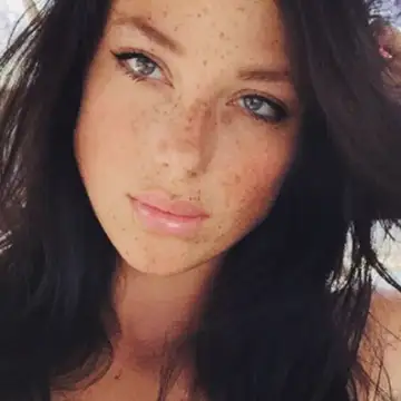 Las pecas se pusieron de moda y ahora también se compran