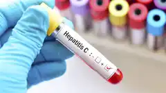 Hepatitis C, una enfermedad silenciosa que se puede curar