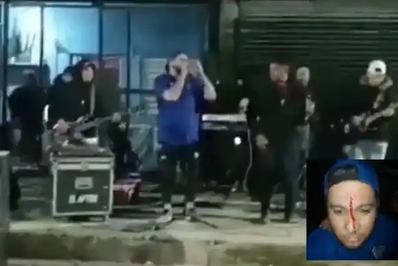 Cansado de la música, un vecino le disparó al cantante de una banda de cumbia con un rifle de aire comprimido