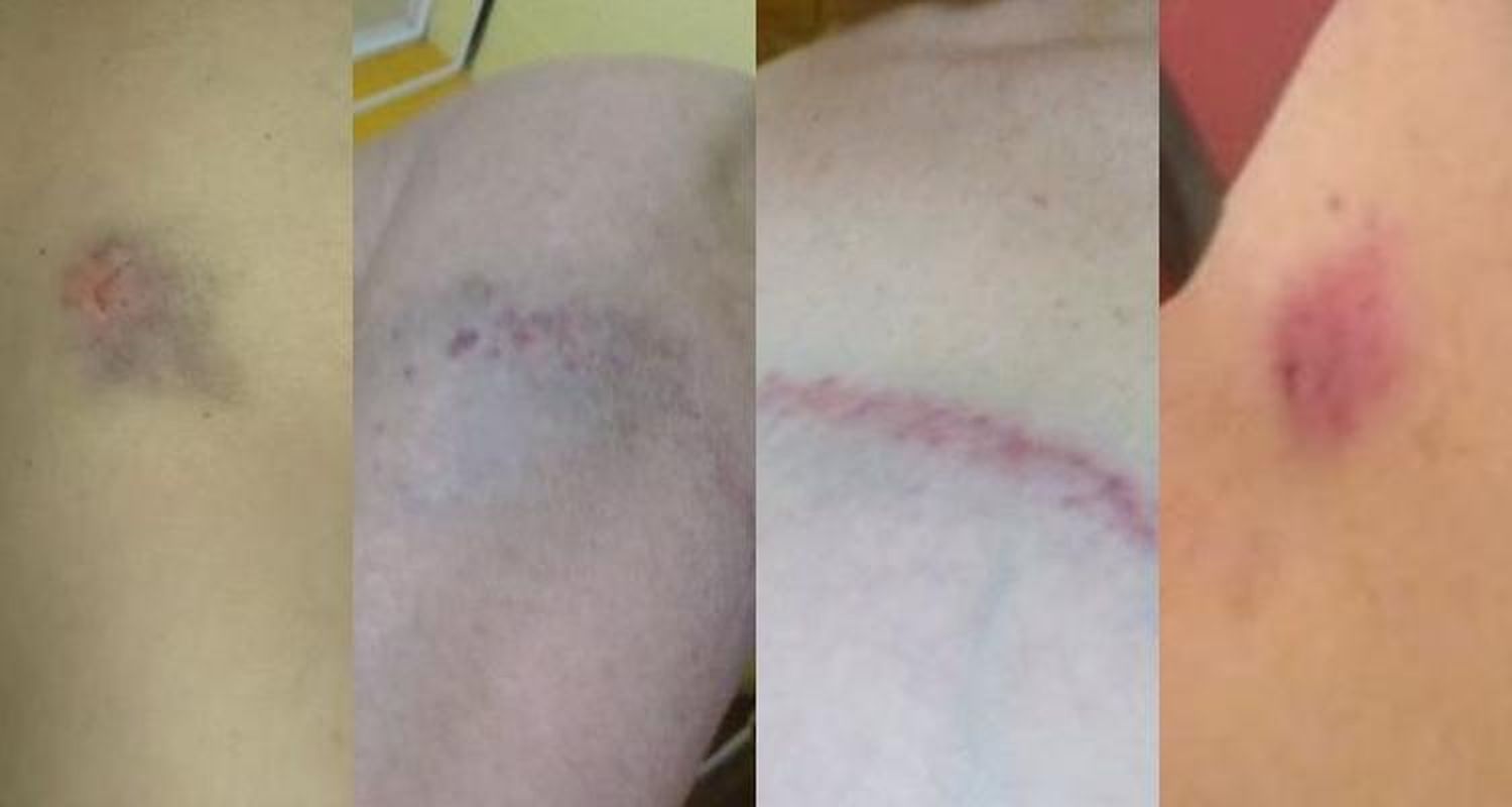 El drama de una mujer que denunció a su expareja por haberle pegado “con un palo” y espera una “restricción perimetral”