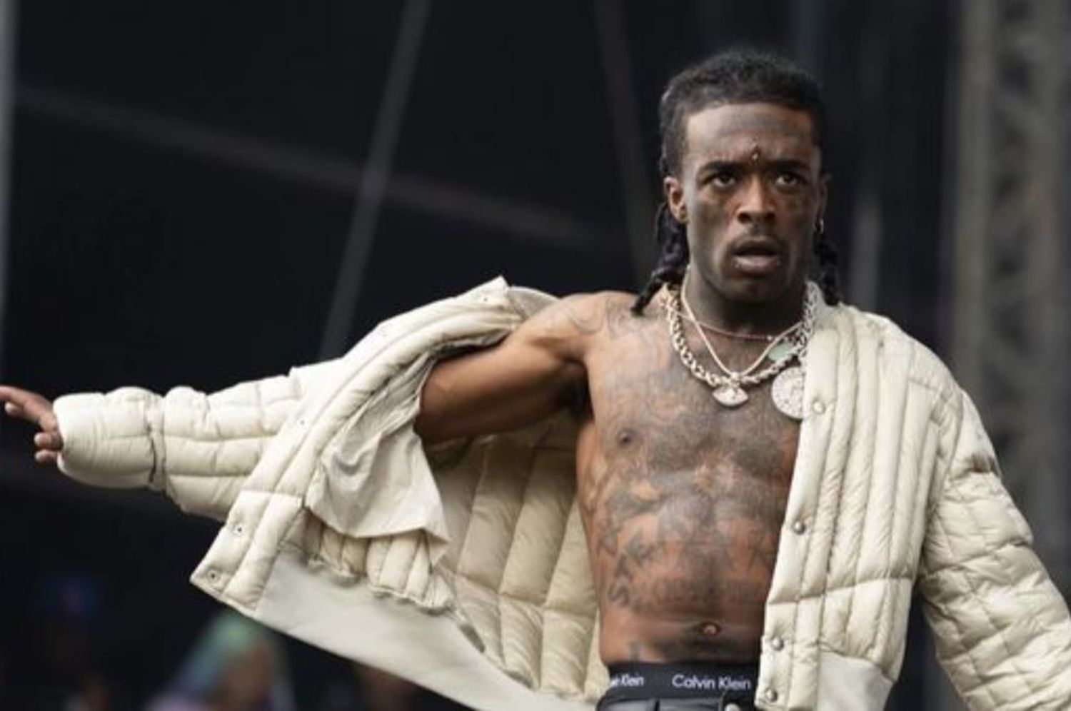 El rapero Lil Uzi Vert se injertó cuatro diamantes en los dedos: mirá cómo le quedaron