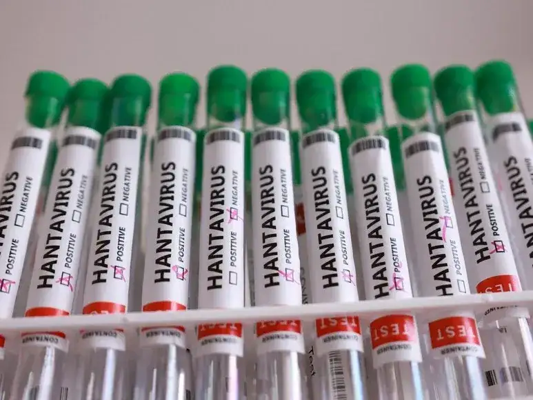 hantavirus