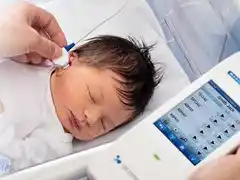 Jornada de evaluación auditiva en el hospital San Antonio