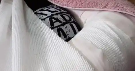 La atacó un perro y se quebró el codo