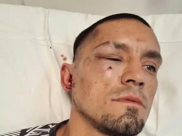El motivo de la pelea que dejó al profesor de kickboxing de Carmen de Areco con múltiples fracturas: “¿Tan piola sos?"