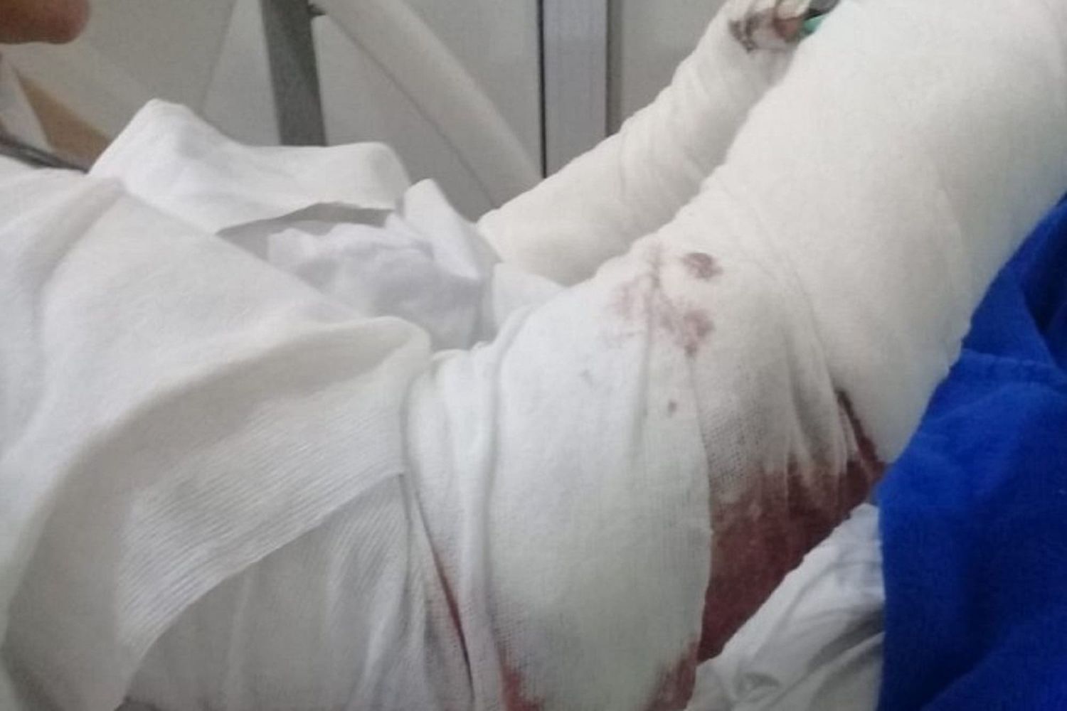 Habló el dueño de los perros que atacaron brutalmente a una mujer en Mar del Plata: "Fallé, pido perdón"