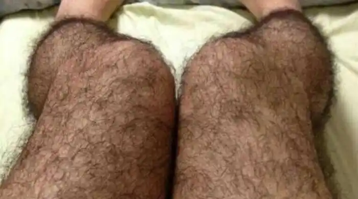 Insólito: hay medias con pelos contra el acoso sexual