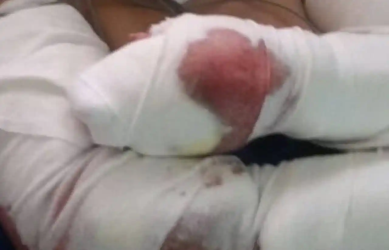 Tres perros atacaron a una mujer en Mar del Plata