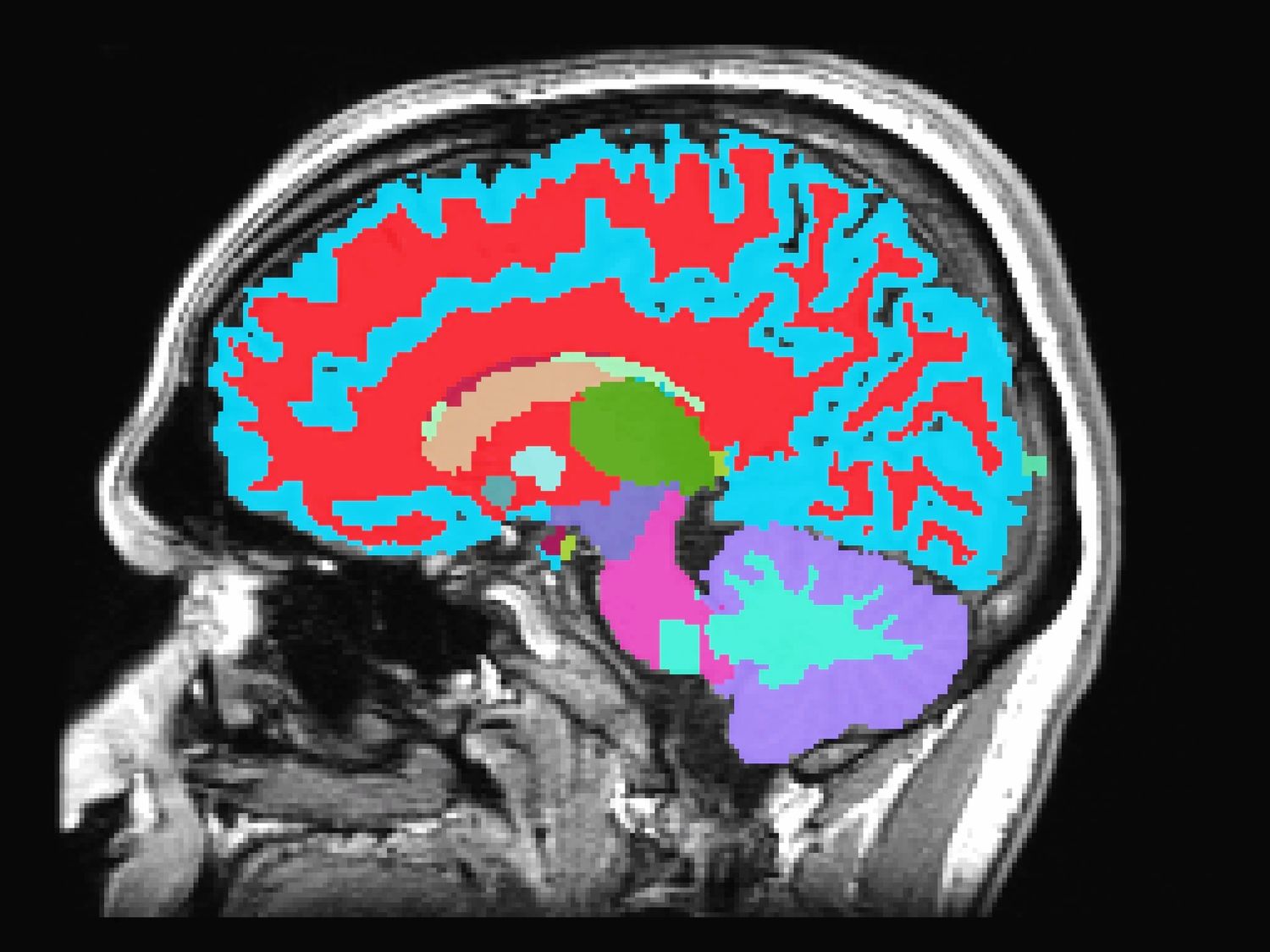 Un simple escáner cerebral determina la velocidad a la que envejecemos