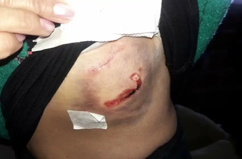 Otra mujer fue víctima de un ataque de perros