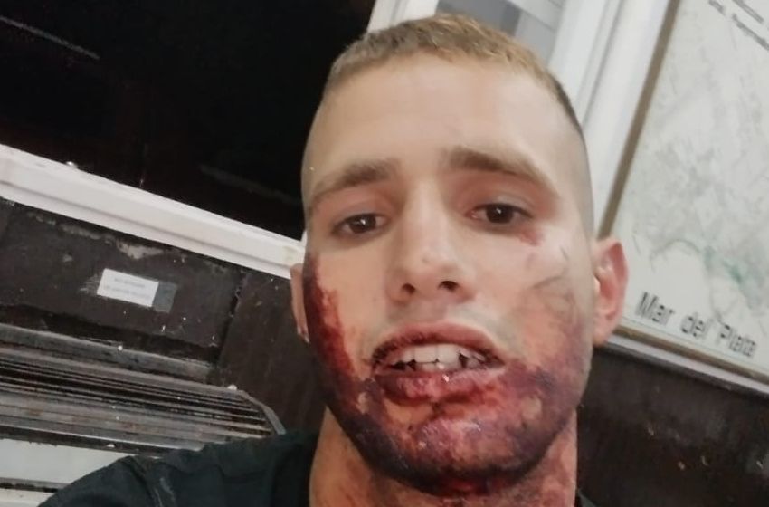 Exclusivo: video del joven que denunció que también fue golpeado en Mr. Jones