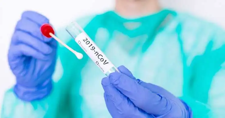 En Argentina se reportaron ayer 88.352 nuevos casos y 51 fallecidos por coronavirus