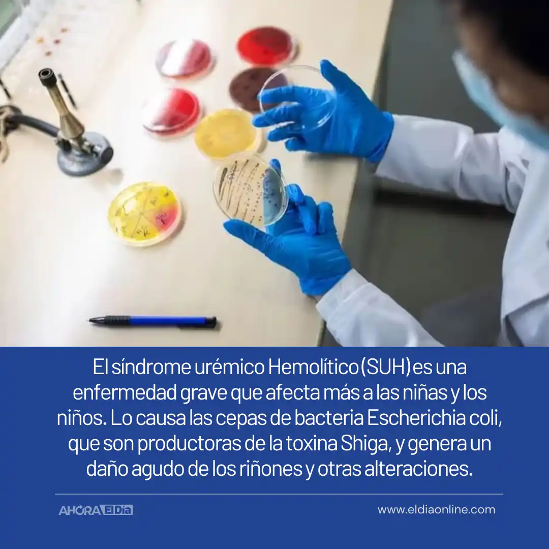 Síndrome Urémico Hemolítico: Cómo prevenir la enfermedad de la “Carne Cruda” - 3