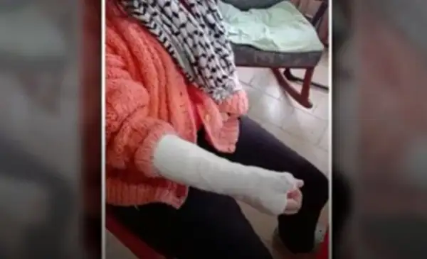 Bullying: le quebraron cuatro dedos y la obligaron a comer pasto