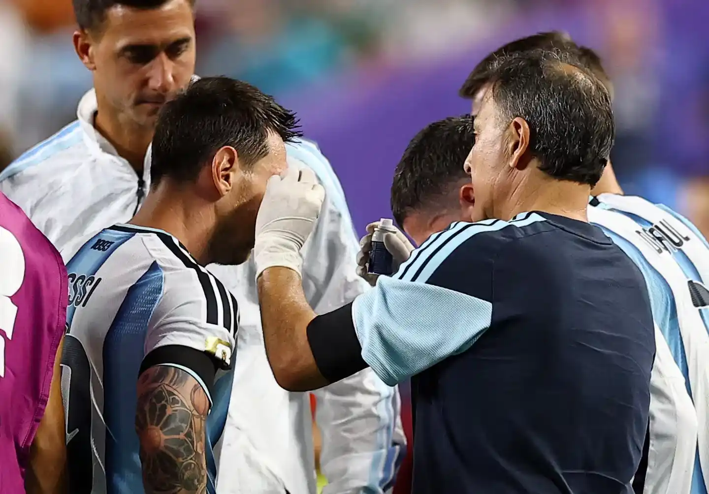 ojo messi - 4