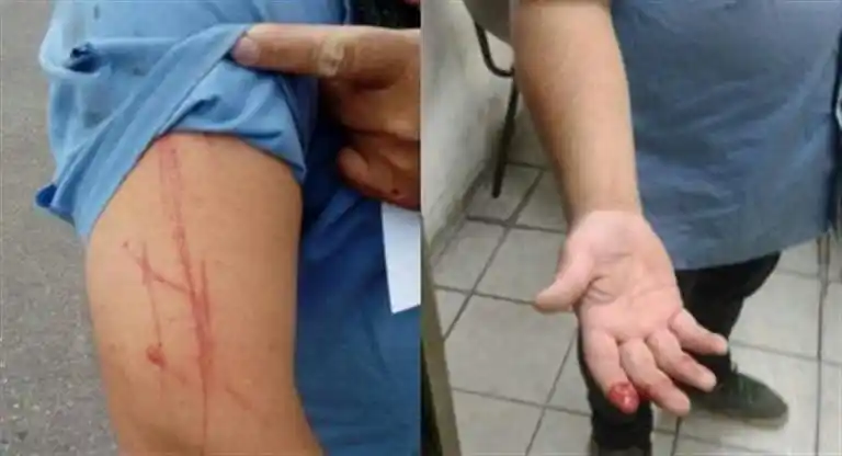 Otro ataque a un colectivero: Ahora acuchillaron a un chofer de la línea 169 en Podestá