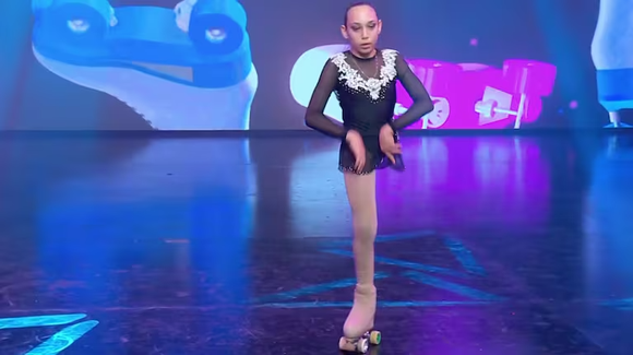 Qué síndrome padece Milagros Trejo, la joven patinadora bonaerense que desafía los límites y emocionó en la TV