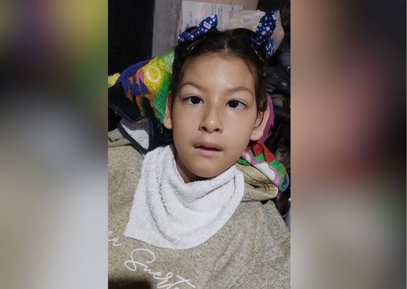 ”La cirugía de Luz fue un éxito”: la niña de 7 años respondió bien a la prótesis de columna
