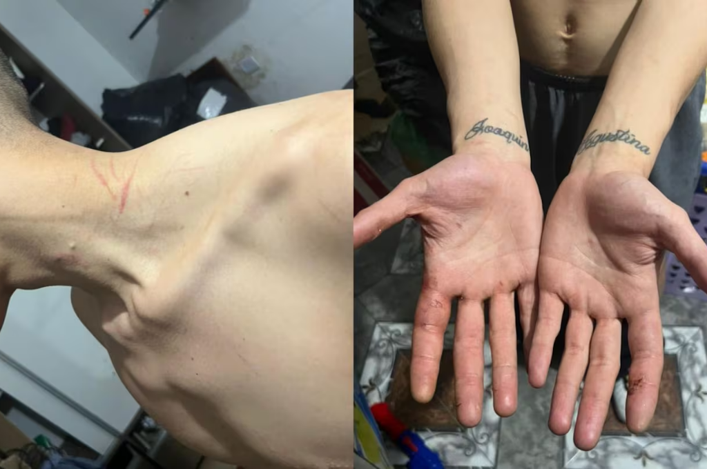 hermano de Ayton preso 2