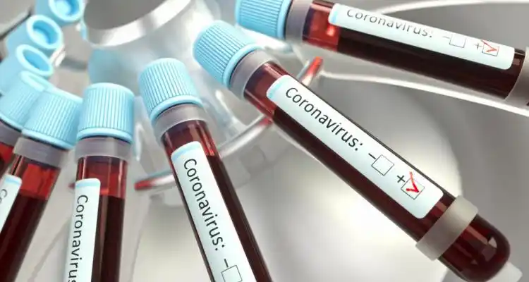 Coronavirus: San Pedro empezó septiembre con 17 nuevos casos positivos