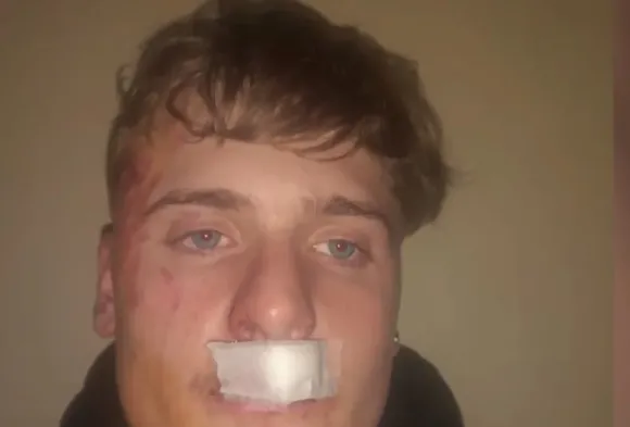 Un joven recibió una brutal golpiza por parte de rugbiers en Zárate: “Pudo ser como Fernando Báez Sosa”