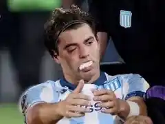 Santiago Sosa sufrió una fractura tras el codazo de Marcos Rojo