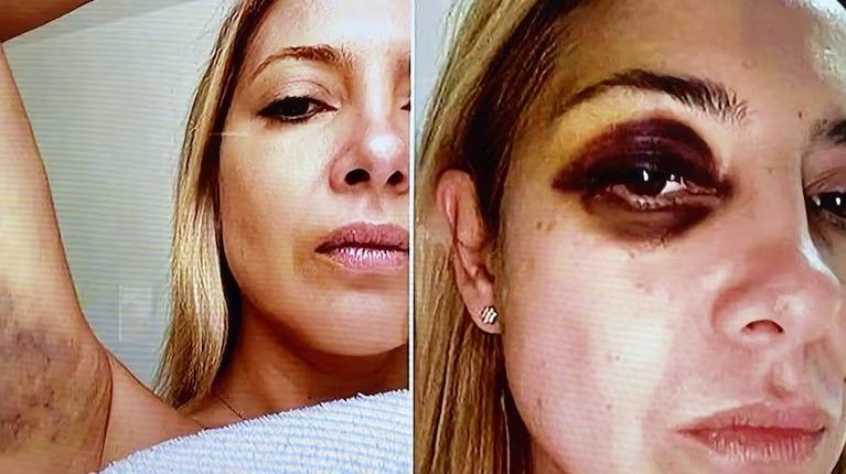 Se conocieron las fotos de Fabiola Yañez golpeada