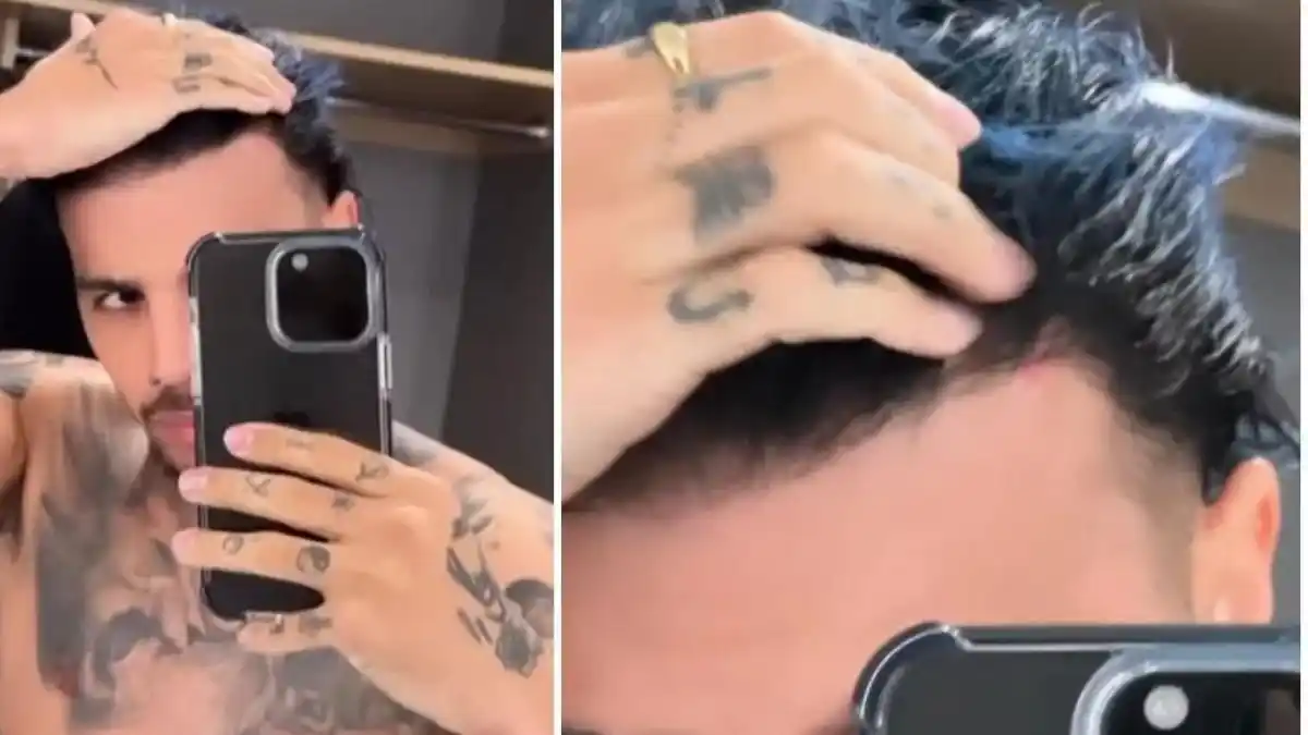 ¡HERIDO Y MOLESTO! Así quedó Rauw Alejandro tras concierto en Bostón (+ Video)