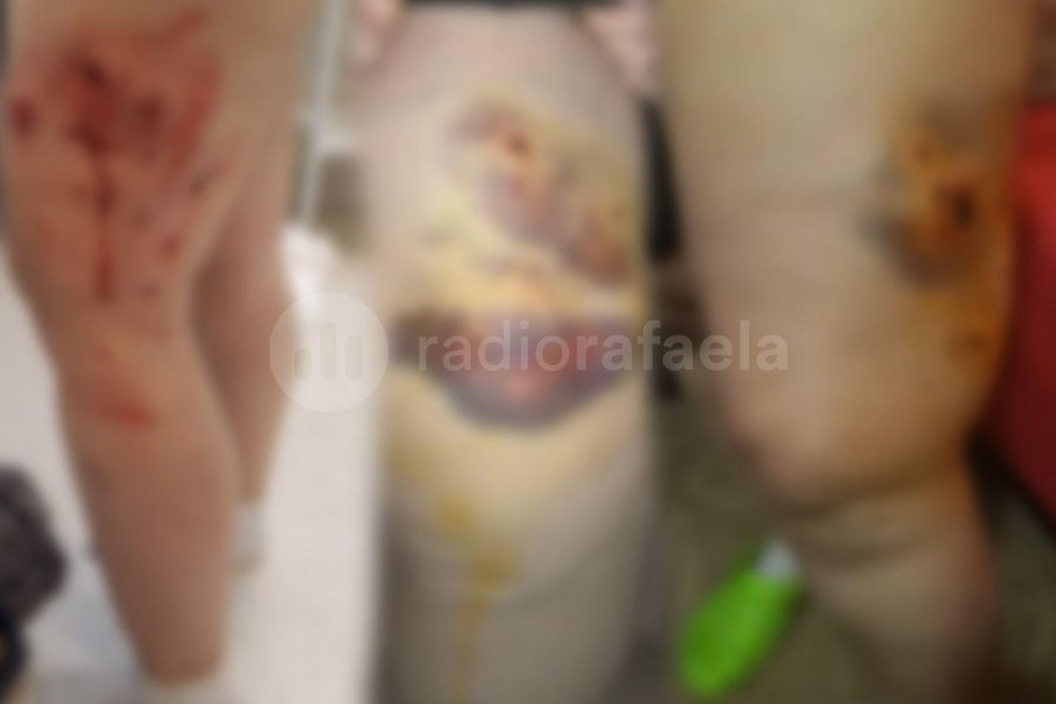 Imágenes sensibles | La mordió un perro Golden y le provocó graves heridas