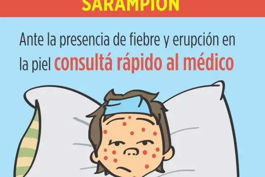 Sarampión: preocupación por dos casos en CABA y uno en la Provincia