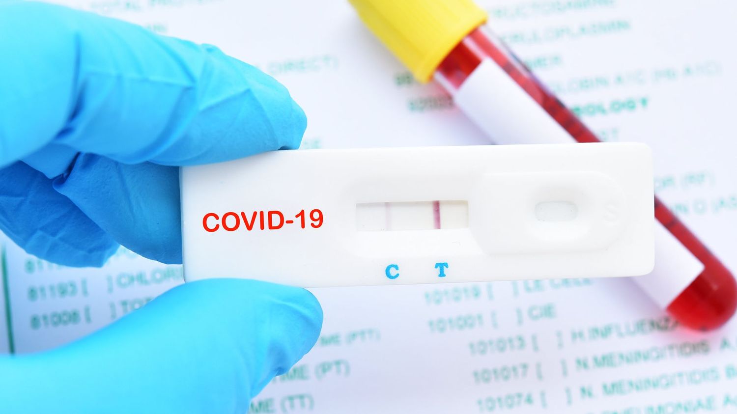 Se registraron 20 nuevos casos de covid-19 en Entre Ríos