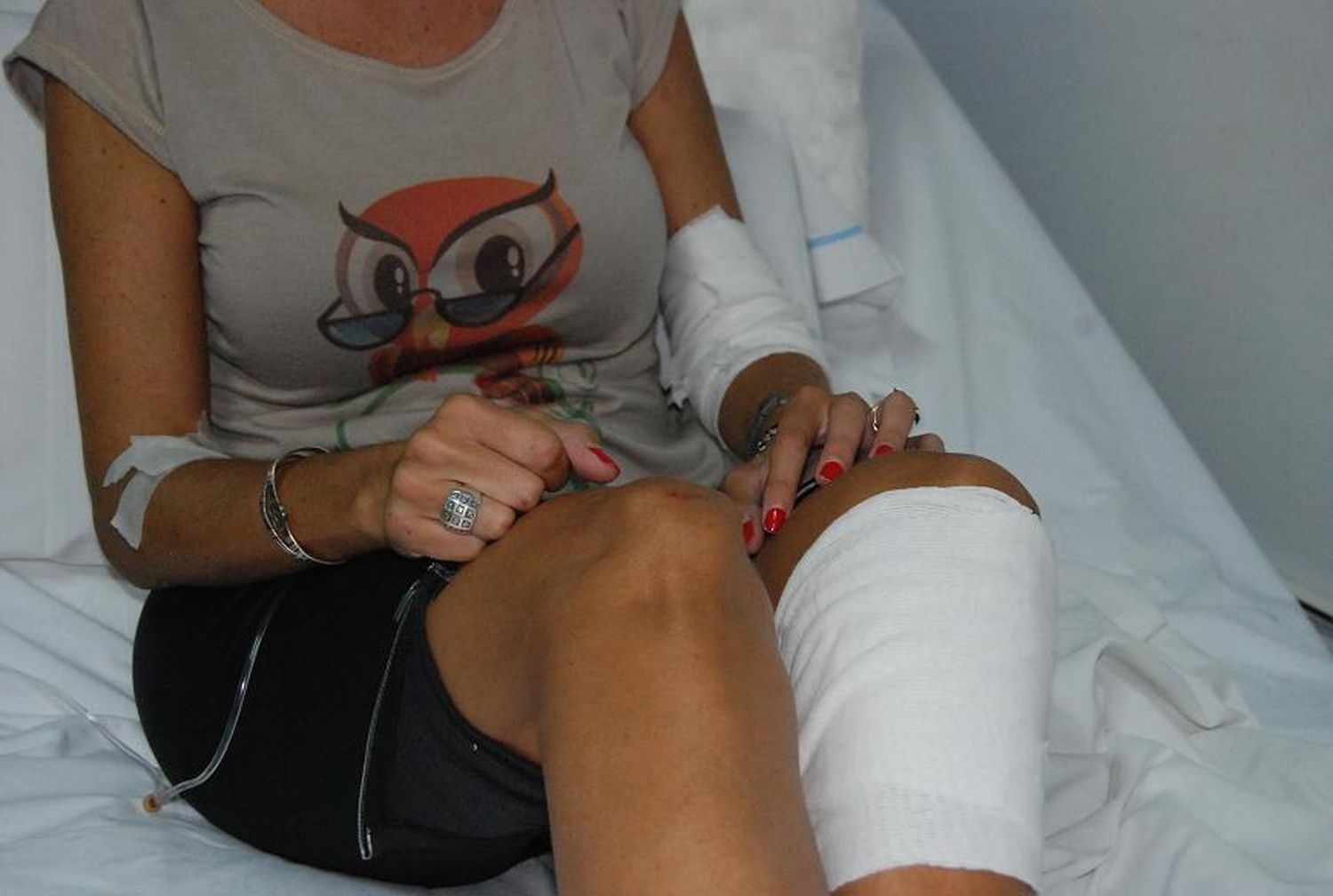 Dos motochorros atacaron violentamente a una mujer y la dejaron inconciente