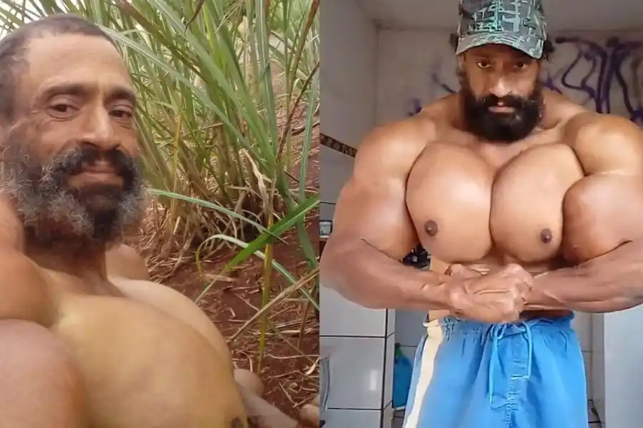 Murió el “Hulk brasileño” por los efectos de inyectarse aceite para aumentar sus músculos durante años