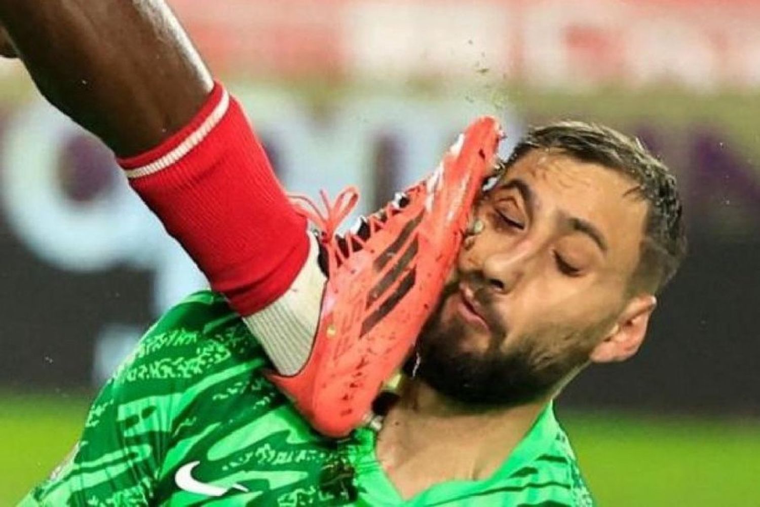 Impactante: la brutal patada que recibió Donnarumma en la Ligue 1