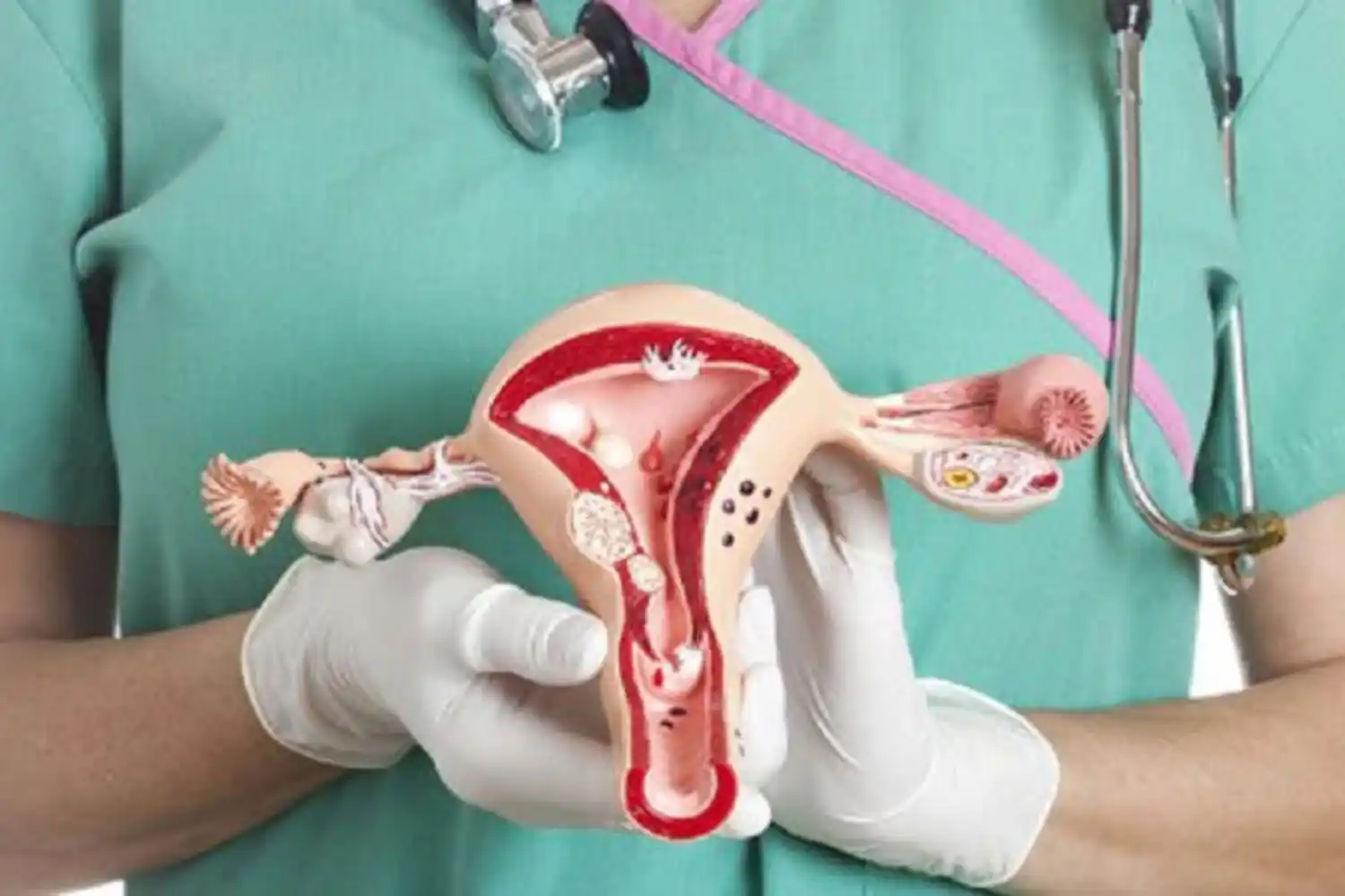Se realizará una nueva campaña de prevención de cáncer de cuello uterino 