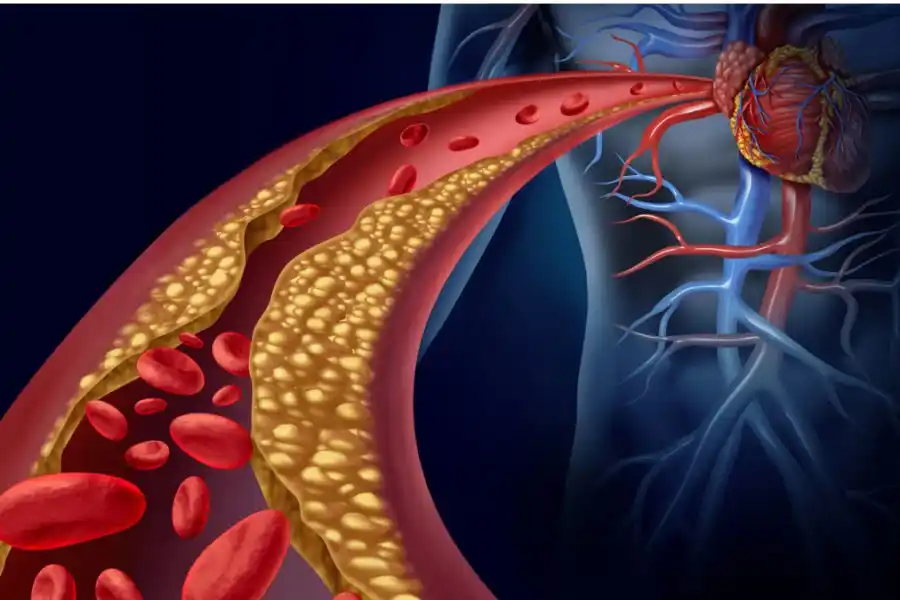 Cinco plantas medicinales para reducir el colesterol alto de forma natural